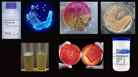 soft agar deep tests for what type of media|Microbiological Culture Media: Types, Role and Composition.